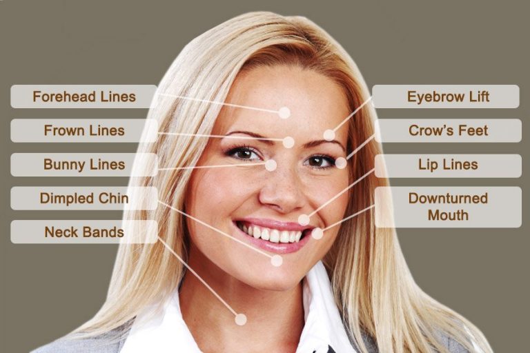 Facial aesthetics treatment options using Botox anti-wrinkle injections