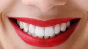 Cosmetic dentistry Formby Liverpool smile makeover