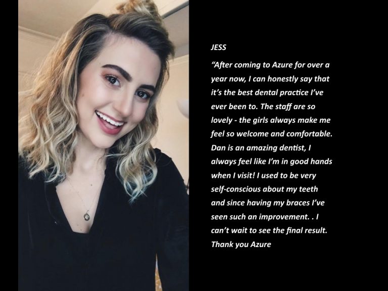 Azure Dental brace patient testimonial