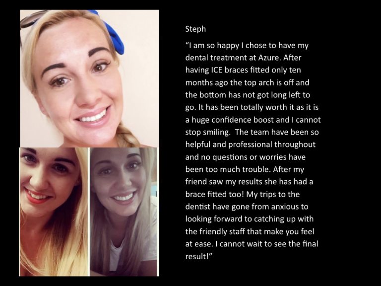 Steph — Azure Dental brace patient testimonial