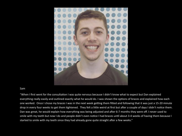 Sam — Azure Dental brace patient testimonial