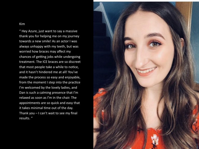 Azure Dental brace patient testimonial