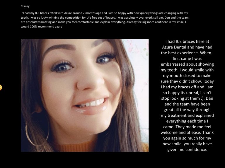 Azure Dental brace patient testimonial