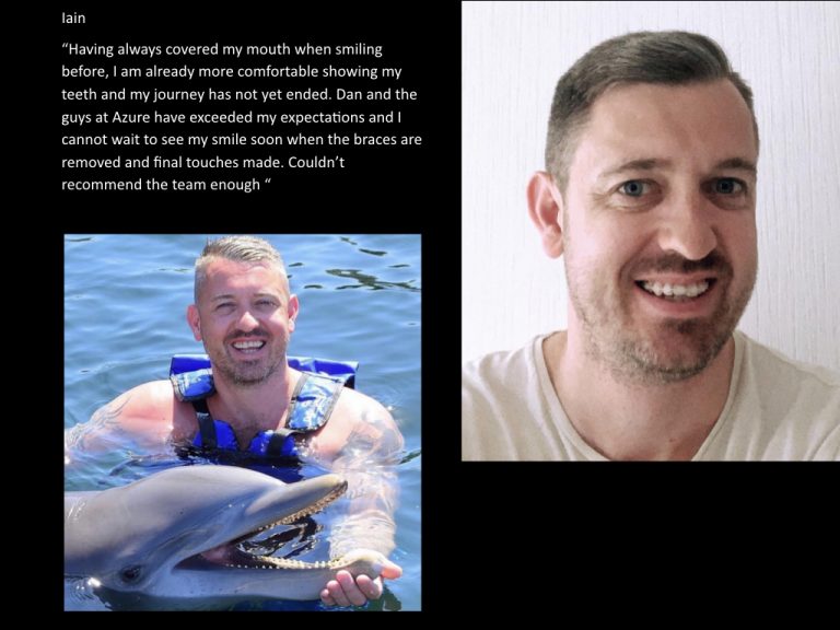 Azure Dental brace patient testimonial