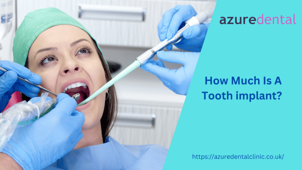 How Much Is A Tooth Implant?