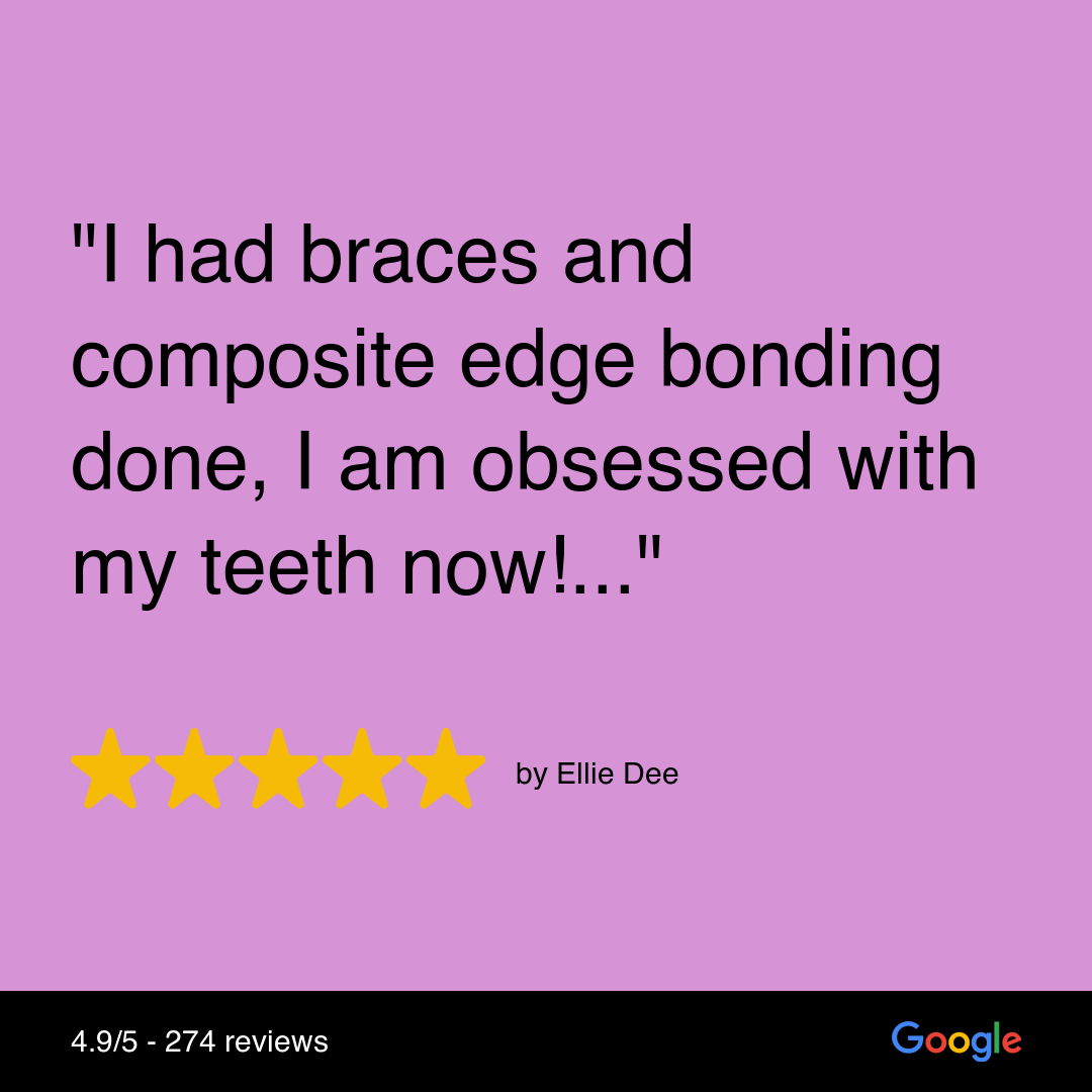 Patient testimonial for Smile Makeover Liverpool