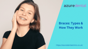 Braces: Types & How They Work