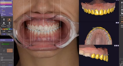 Cosmetic dentist in Southport using digital smile design software showing a proposed smile
