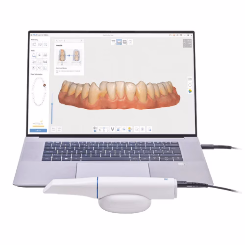 Intra-oral scanner in use at Azure Dental, cosmetic dentist southport