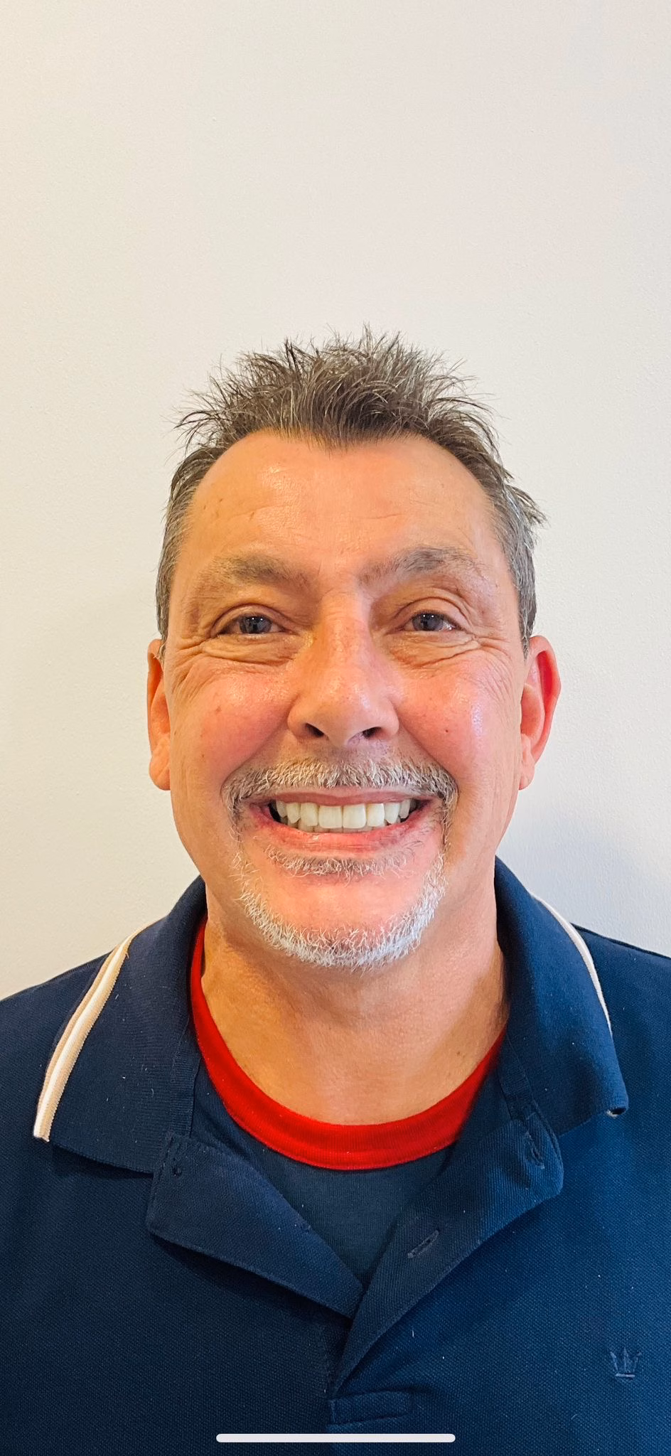 After: definitive zirconia full-arch bridge – natural smile restored