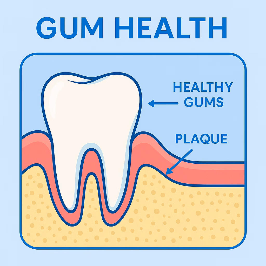 Gum health and plaque illustration used at Azure Dental Liverpool
