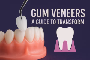 An image of a model with gum veneers in place