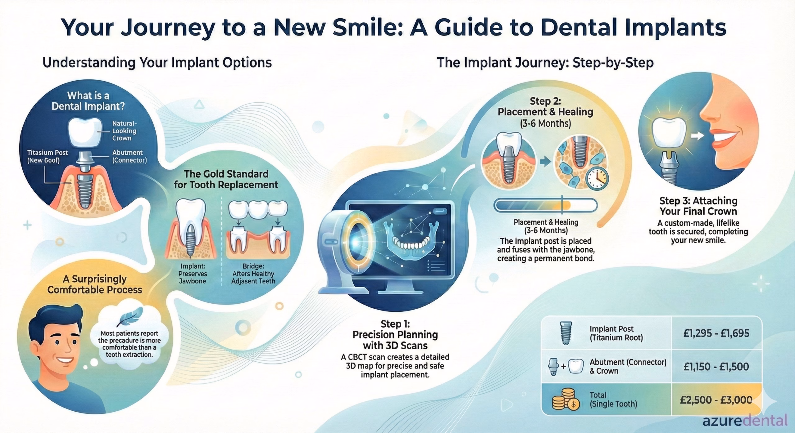 Digital planning and CBCT guided implant placement