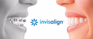 Image showing a split picture with someone wearing traditional braces and Invisalign