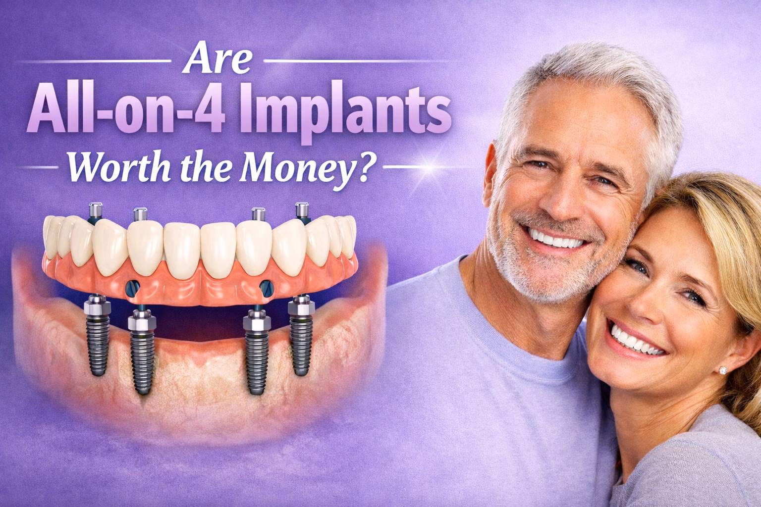 Are All-on-4 implants worth the money? Full arch dental implants and fixed teeth in a day