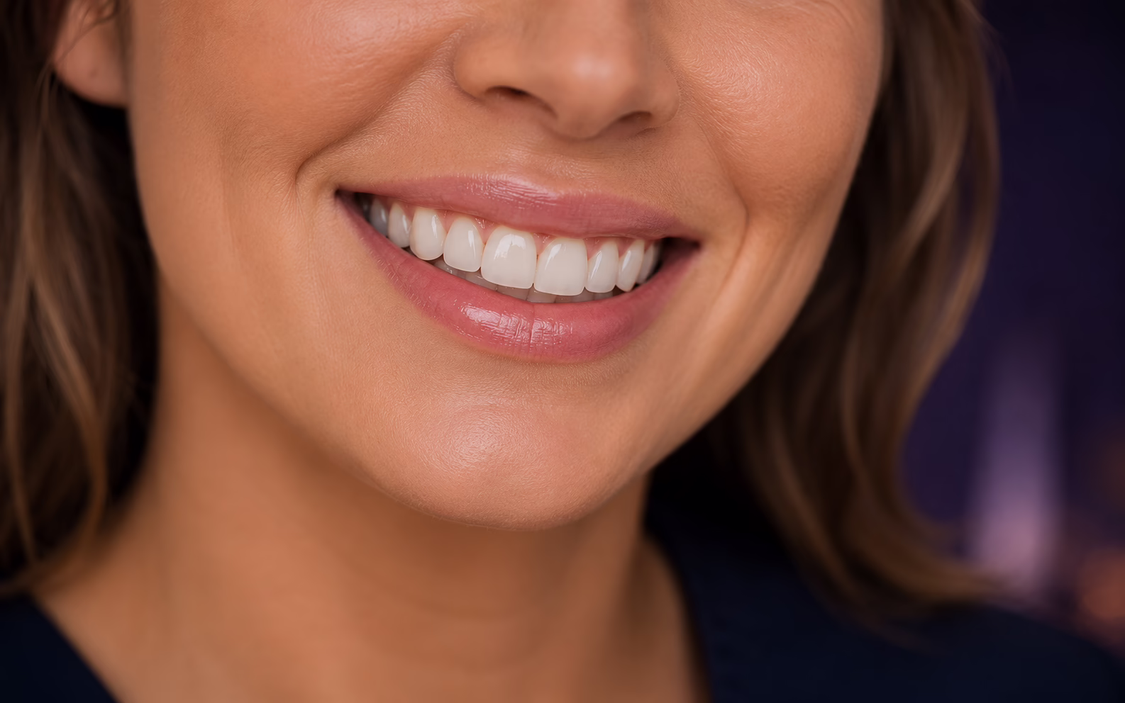 Natural crown and veneer smile comparison at Azure Dental