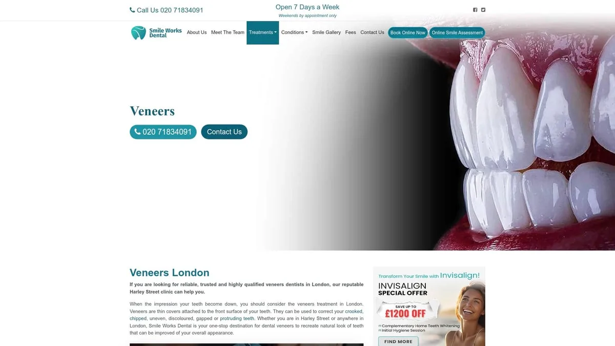 Top 7 Best Veneers Near Me for a Stunning Smile in 2026 - SmileWorks Dental – Manchester
